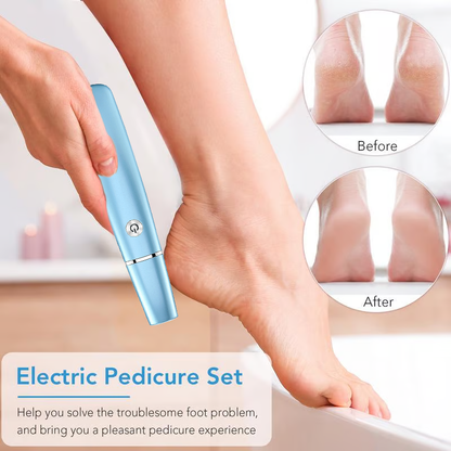 🔥LAST DAY SALE 49% OFF🔥Electric Feet Callus Remover