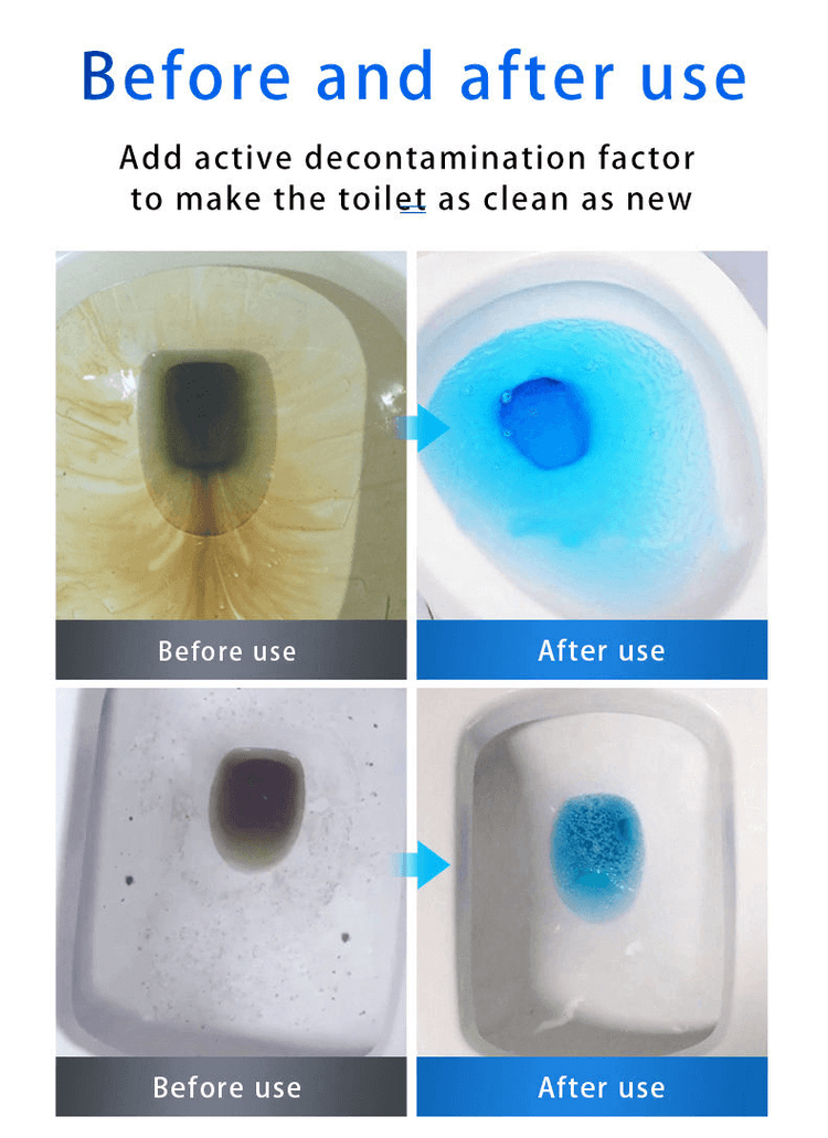 🔥HOT SALE BUY 2 GET 1 FREE🔥 SINK & DRAIN CLEANER-8