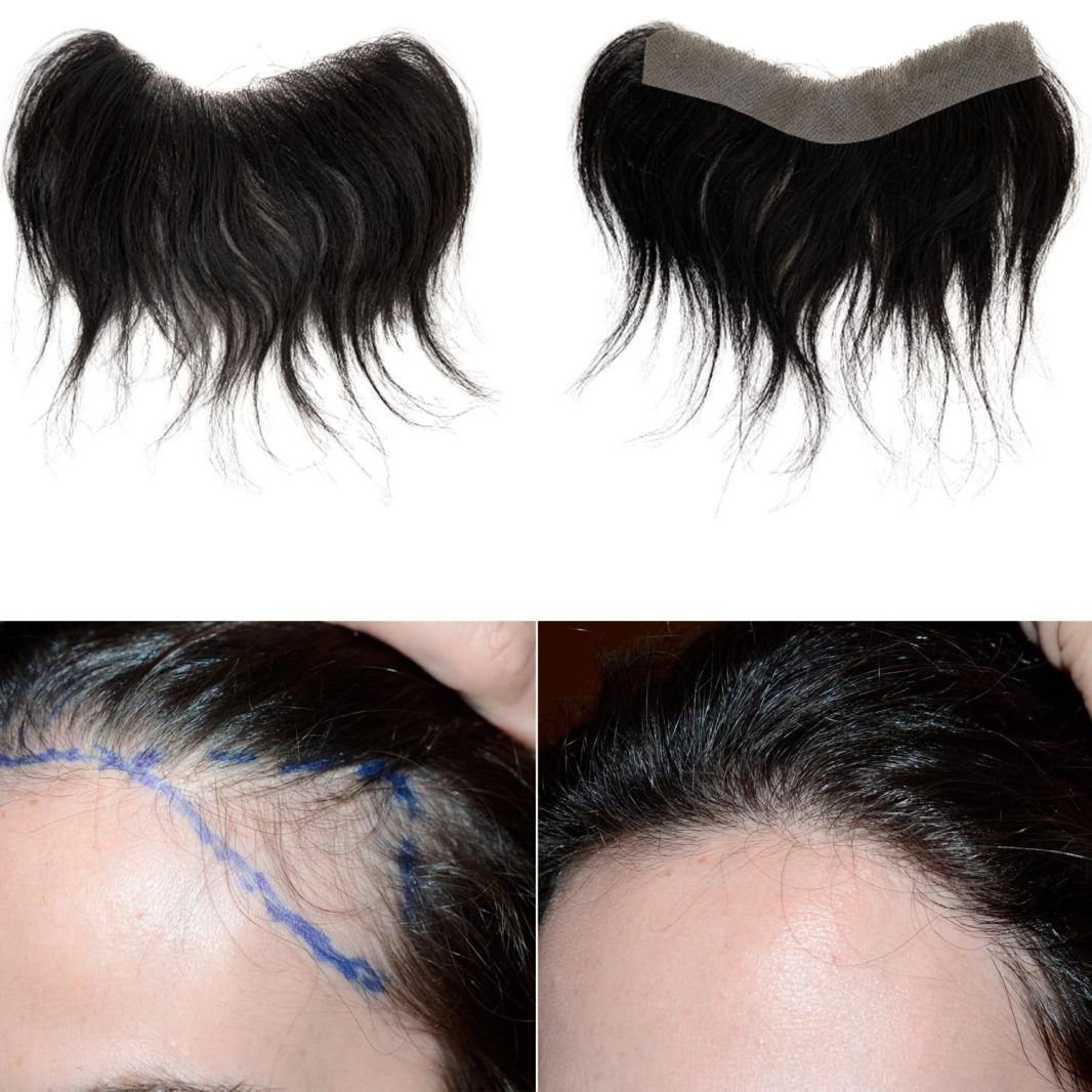 🎁Hot Sale 49% OFF🔥No glue Hairline Toupee For Women (Real hair)-7