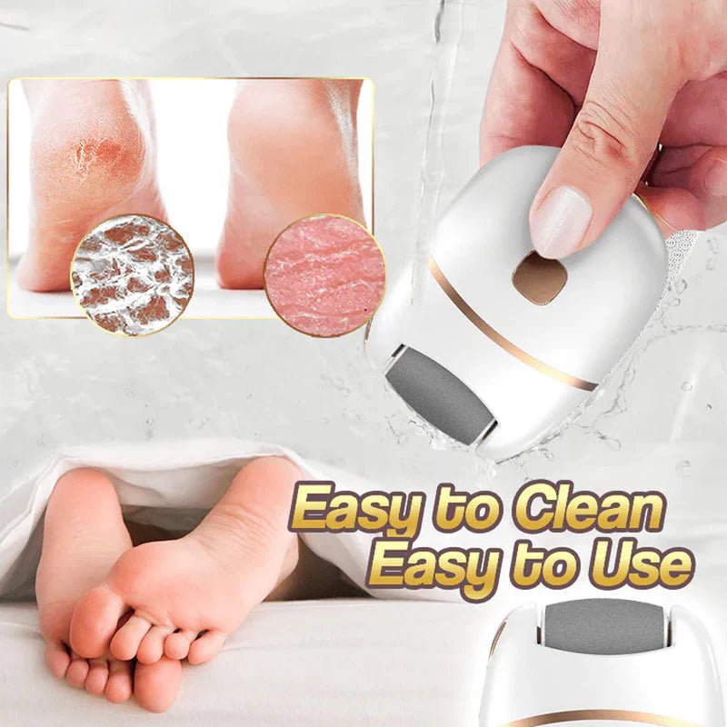 🔥HOT SALE 49% OFF🔥Rechargeable Electric Foot Exfoliating Scrubber-3