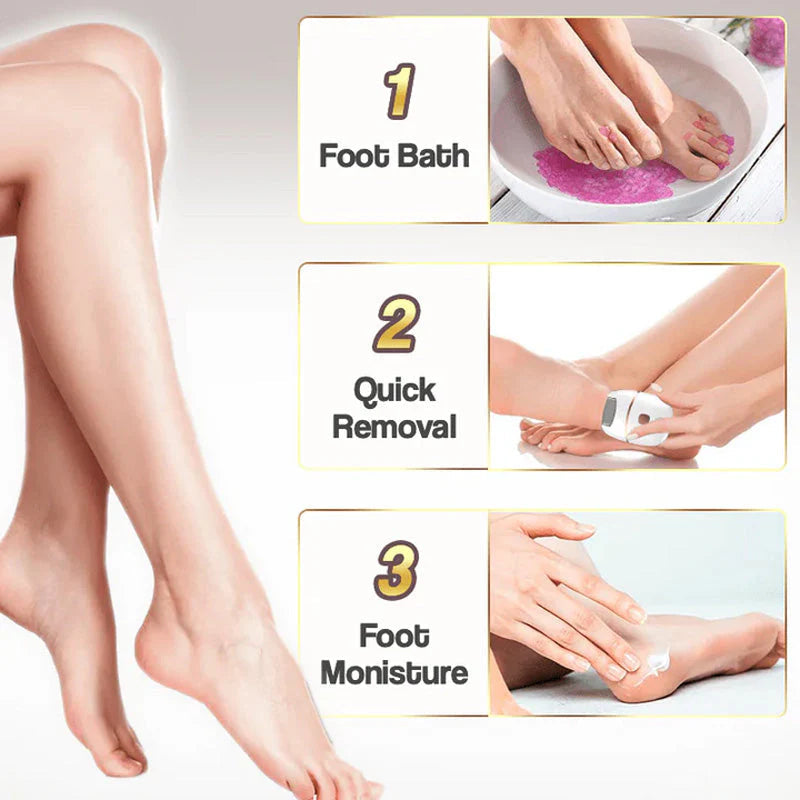 🔥HOT SALE 49% OFF🔥Rechargeable Electric Foot Exfoliating Scrubber-4