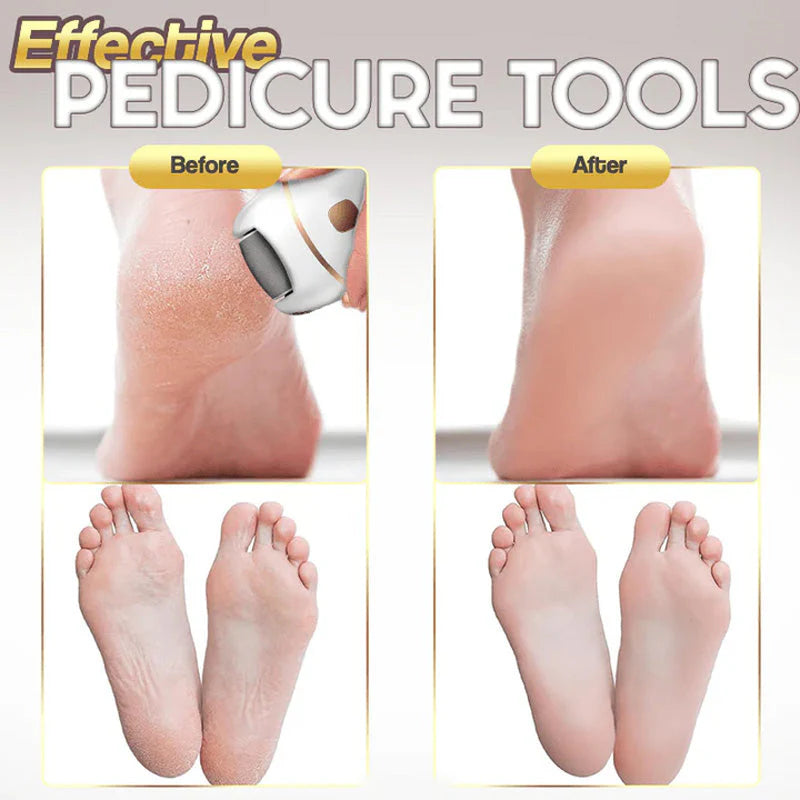 🔥HOT SALE 49% OFF🔥Rechargeable Electric Foot Exfoliating Scrubber-5